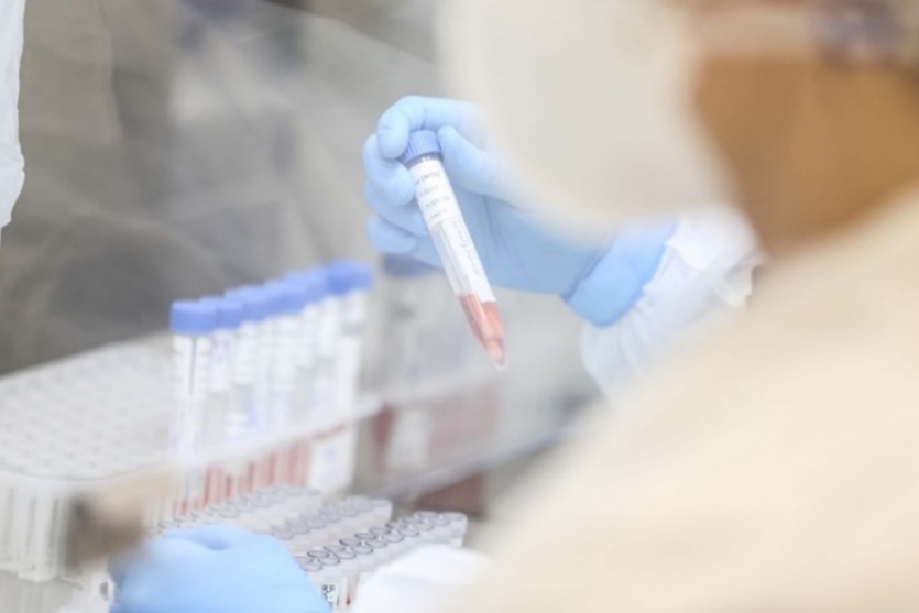 brasil-ultrapassa-marca-de-mil-casos-de-mpox-ate-a-primeira-semana-de-setembro